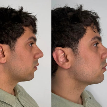 Cepillo Facial Linfático Dual Contour